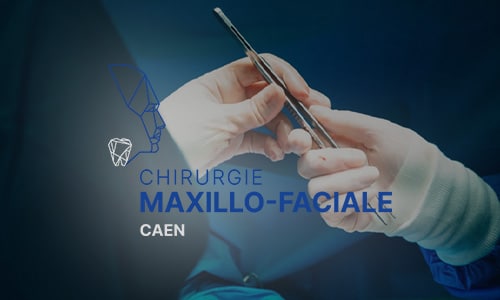Site internet de Maxillo faciale CAEN